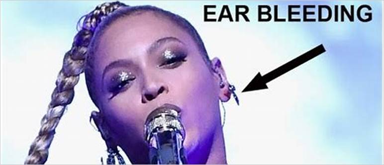 Beyonce ear bleeding